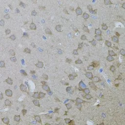 Anti-ARF1 antibody used in IHC (Paraffin sections) (IHC-P). GTX32454