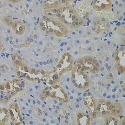 Anti-ARF1 antibody used in IHC (Paraffin sections) (IHC-P). GTX32454