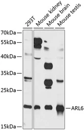Anti-ARL6 antibody used in Western Blot (WB). GTX32455