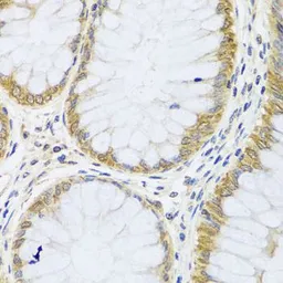 Anti-ARL6 antibody used in IHC (Paraffin sections) (IHC-P). GTX32455