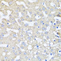 Anti-ARL6 antibody used in IHC (Paraffin sections) (IHC-P). GTX32455