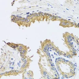 Anti-ARL6 antibody used in IHC (Paraffin sections) (IHC-P). GTX32455