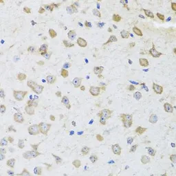 Anti-ARL6 antibody used in IHC (Paraffin sections) (IHC-P). GTX32455