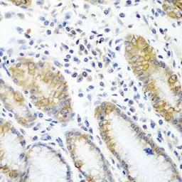 Anti-ATAD3A antibody used in IHC (Paraffin sections) (IHC-P). GTX32458