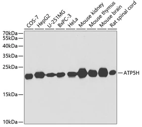 Anti-ATP5H antibody used in Western Blot (WB). GTX32460