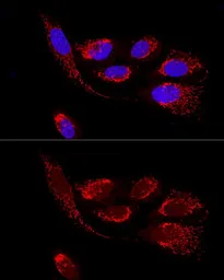 Anti-ATP5H antibody used in Immunocytochemistry/ Immunofluorescence (ICC/IF). GTX32460