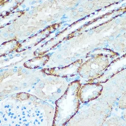 Anti-ATP5H antibody used in IHC (Paraffin sections) (IHC-P). GTX32460