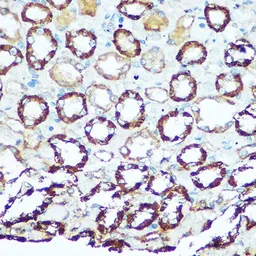 Anti-ATP5H antibody used in IHC (Paraffin sections) (IHC-P). GTX32460