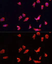 Anti-ATP6V1B2 antibody used in Immunocytochemistry/ Immunofluorescence (ICC/IF). GTX32461