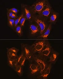 Anti-BAK antibody used in Immunocytochemistry/ Immunofluorescence (ICC/IF). GTX32463