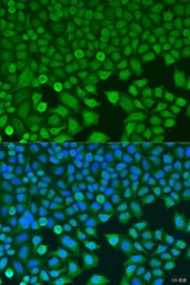 Anti-BCKDK antibody used in Immunocytochemistry/ Immunofluorescence (ICC/IF). GTX32468