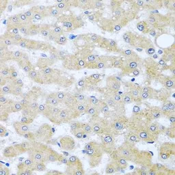 Anti-BCKDK antibody used in IHC (Paraffin sections) (IHC-P). GTX32468
