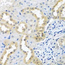 Anti-BCKDK antibody used in IHC (Paraffin sections) (IHC-P). GTX32468