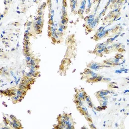 Anti-BCKDK antibody used in IHC (Paraffin sections) (IHC-P). GTX32468