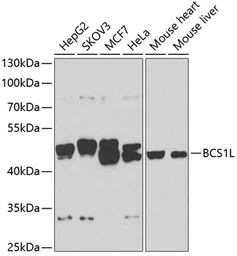 Anti-BCS1L antibody used in Western Blot (WB). GTX32469
