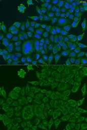 Anti-BCS1L antibody used in Immunocytochemistry/ Immunofluorescence (ICC/IF). GTX32469