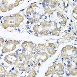 Anti-BCS1L antibody used in IHC (Paraffin sections) (IHC-P). GTX32469