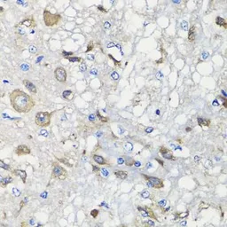 Anti-BCS1L antibody used in IHC (Paraffin sections) (IHC-P). GTX32469