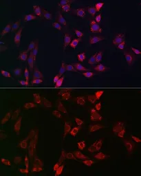 Anti-Bid antibody used in Immunocytochemistry/ Immunofluorescence (ICC/IF). GTX32471