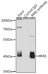 Anti-Bmi1 antibody used in Immunoprecipitation (IP). GTX32472
