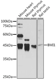 Anti-Bmi1 antibody used in Western Blot (WB). GTX32472