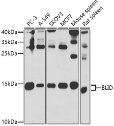 Anti-BRCC2 antibody used in Western Blot (WB). GTX32477