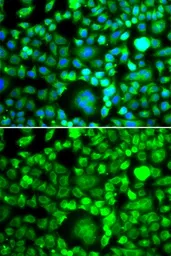 Anti-BRCC2 antibody used in Immunocytochemistry/ Immunofluorescence (ICC/IF). GTX32477