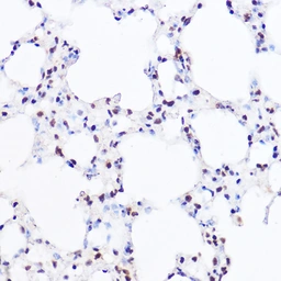 Anti-BRG1 antibody used in Immunoprecipitation (IP). GTX32478