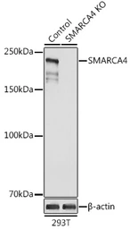 Anti-BRG1 antibody used in Western Blot (WB). GTX32478