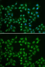 Anti-BTK antibody used in Immunocytochemistry/ Immunofluorescence (ICC/IF). GTX32479