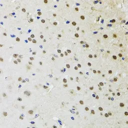Anti-BTK antibody used in IHC (Paraffin sections) (IHC-P). GTX32479
