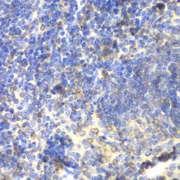 Anti-BTK antibody used in IHC (Paraffin sections) (IHC-P). GTX32479