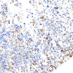 Anti-BTK antibody used in IHC (Paraffin sections) (IHC-P). GTX32479