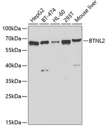 Anti-BTNL2 antibody used in Western Blot (WB). GTX32480