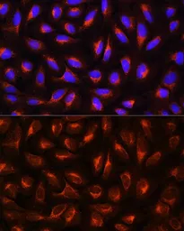 Anti-C Reactive Protein antibody used in Immunocytochemistry/ Immunofluorescence (ICC/IF). GTX32481