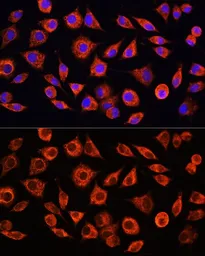 Anti-C Reactive Protein antibody used in Immunocytochemistry/ Immunofluorescence (ICC/IF). GTX32481