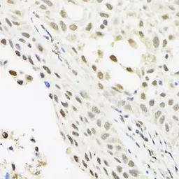 Anti-C14orf166 antibody used in IHC (Paraffin sections) (IHC-P). GTX32482