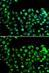 Anti-C16orf80 antibody used in Immunocytochemistry/ Immunofluorescence (ICC/IF). GTX32483