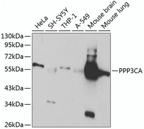 Anti-Calcineurin A antibody used in Western Blot (WB). GTX32485