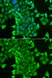 Anti-CARS antibody used in Immunocytochemistry/ Immunofluorescence (ICC/IF). GTX32489
