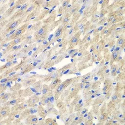 Anti-CARS antibody used in IHC (Paraffin sections) (IHC-P). GTX32489