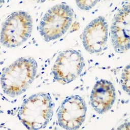 Anti-Cathepsin G antibody used in IHC (Paraffin sections) (IHC-P). GTX32491
