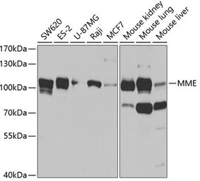 Anti-CD10 antibody used in Western Blot (WB). GTX32493