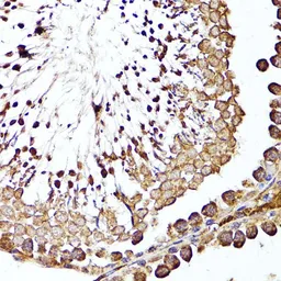 Anti-CD10 antibody used in IHC (Paraffin sections) (IHC-P). GTX32493