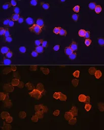 Anti-CD14 antibody used in Immunocytochemistry/ Immunofluorescence (ICC/IF). GTX32497