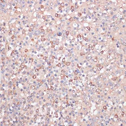 Anti-CD14 antibody used in IHC (Paraffin sections) (IHC-P). GTX32497