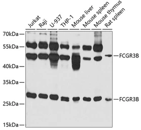 Anti-CD16b antibody used in Western Blot (WB). GTX32499
