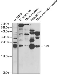Anti-CD42a antibody used in Western Blot (WB). GTX32502