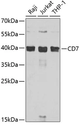 Anti-CD7 antibody used in Western Blot (WB). GTX32505