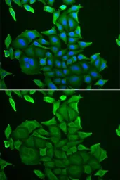 Anti-CD84 antibody used in Immunocytochemistry/ Immunofluorescence (ICC/IF). GTX32506
